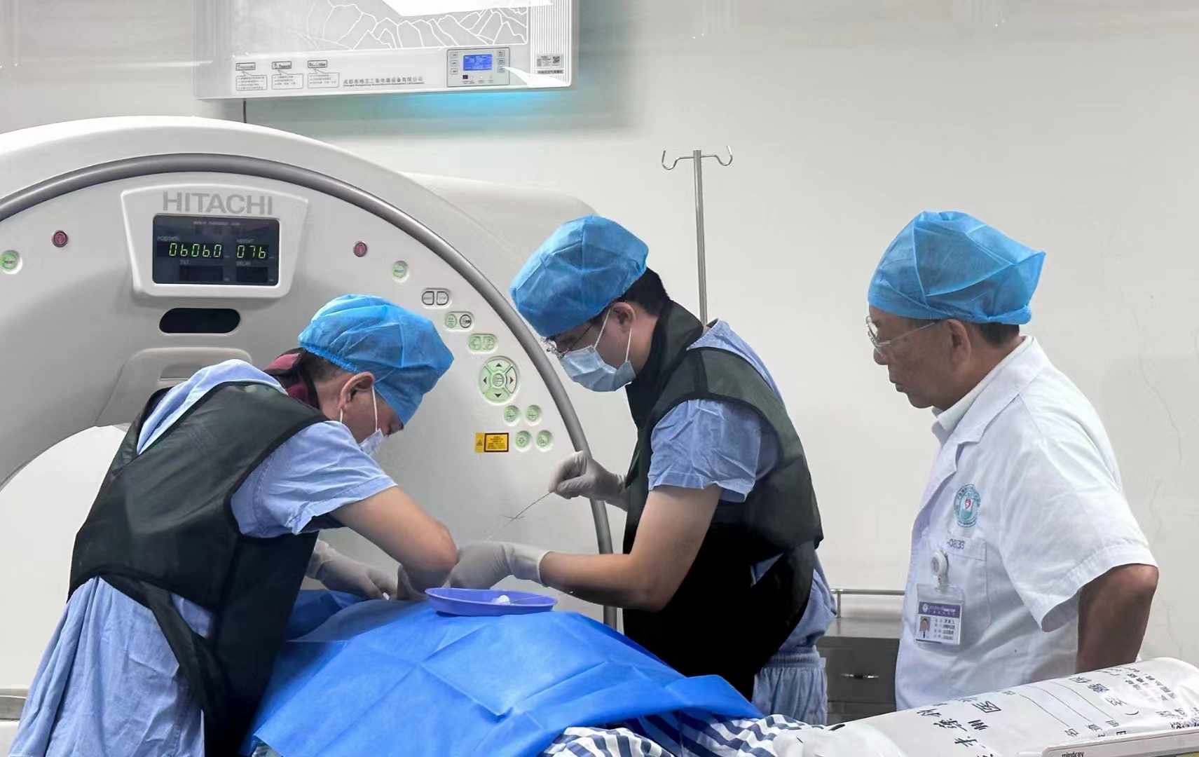 颅内肿瘤复发怎么办？粒子植入精细内放疗来帮忙